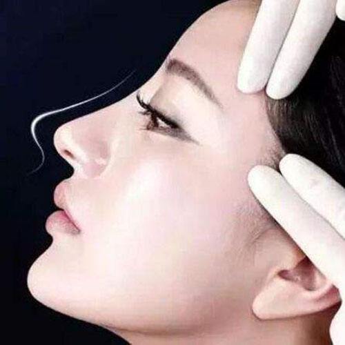 杭州隆鼻医生哪个做的好？很多人做鼻修复，担心选错医生！