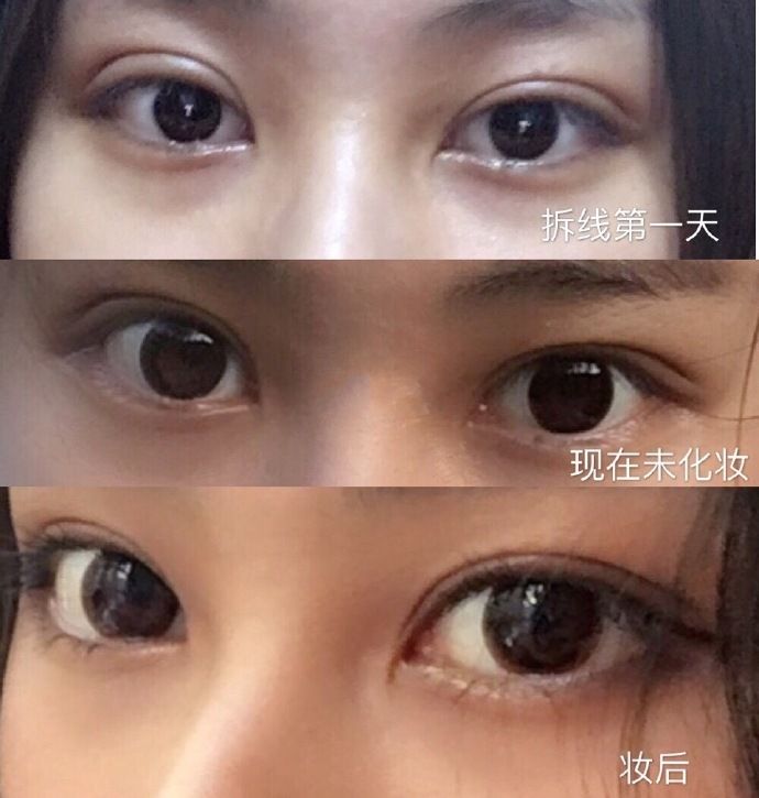 上海九院眼睛修复专家排名