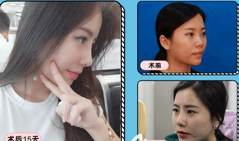 北京哪个医生做鼻子最好？