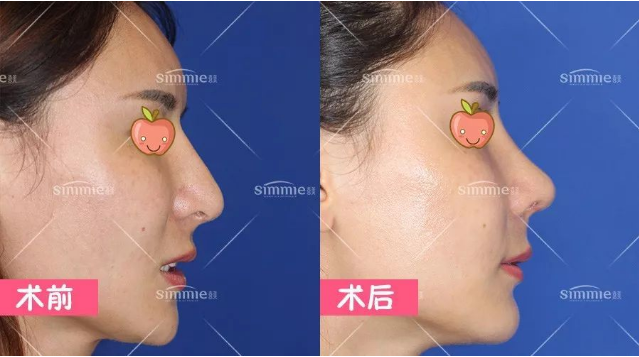 深圳鼻修复专家有哪些？