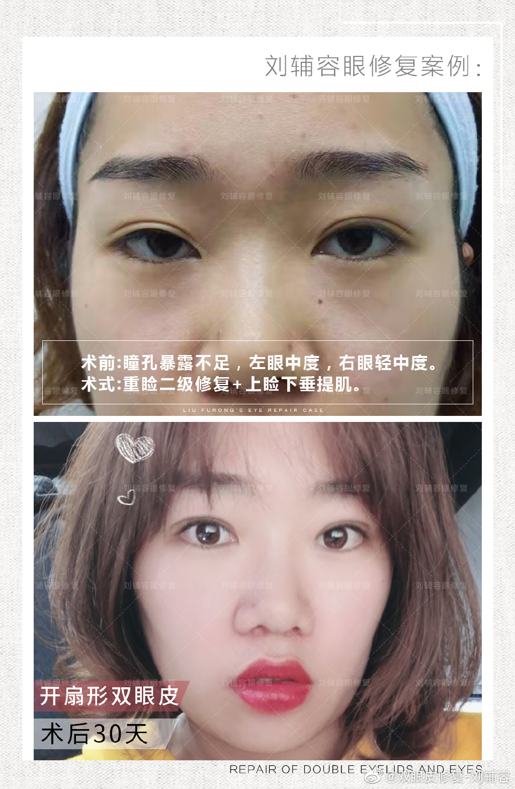 中国的眼部修复最好的专家：刘辅容和刘志刚哪个好？