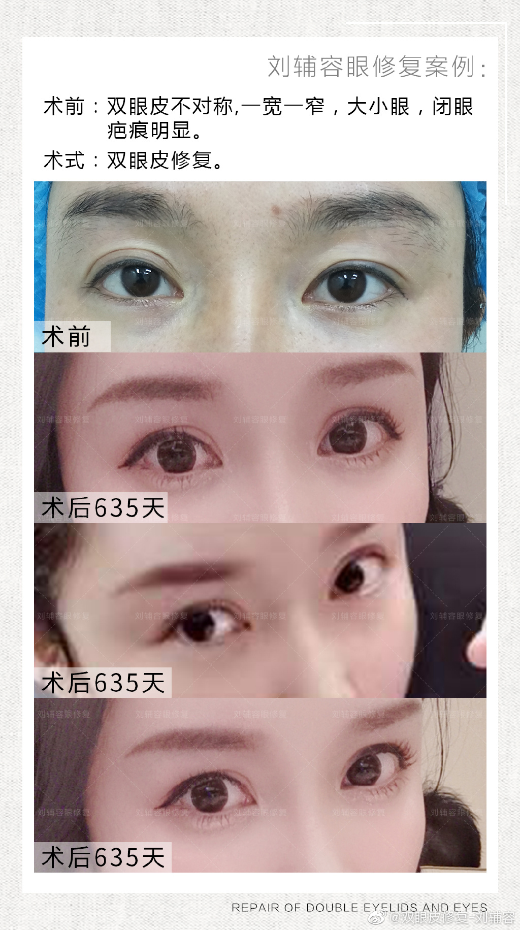中国的眼部修复最好的专家：刘辅容和刘志刚哪个好？