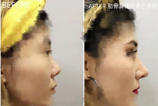 国内最厉害的鼻修复专家：范飞和戴传昌哪个好？